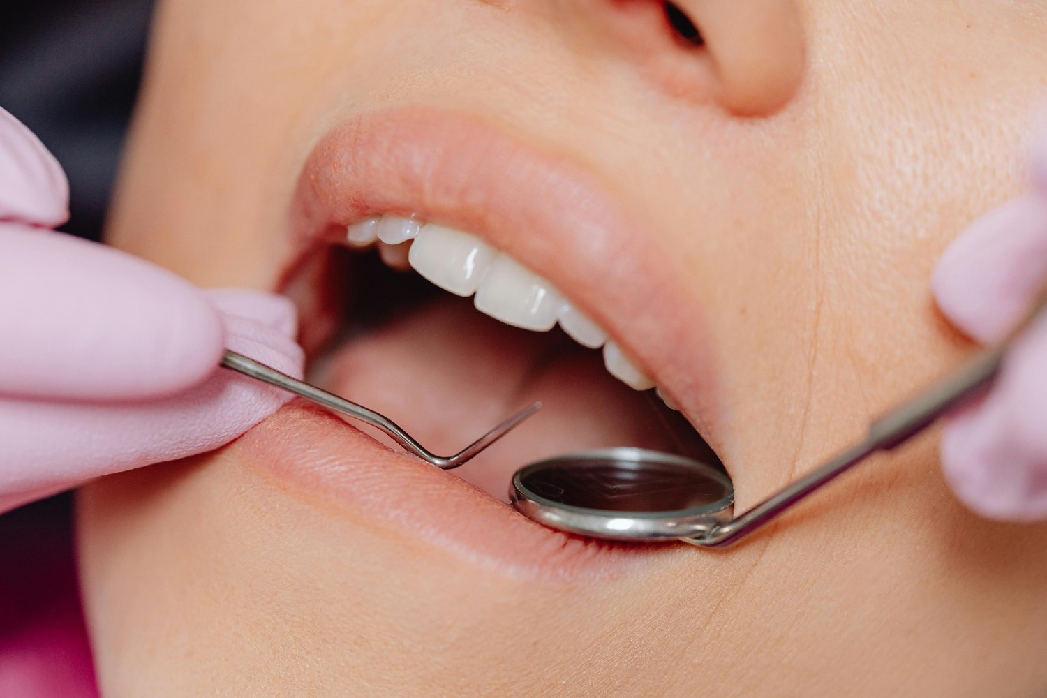 Gum Treatment
